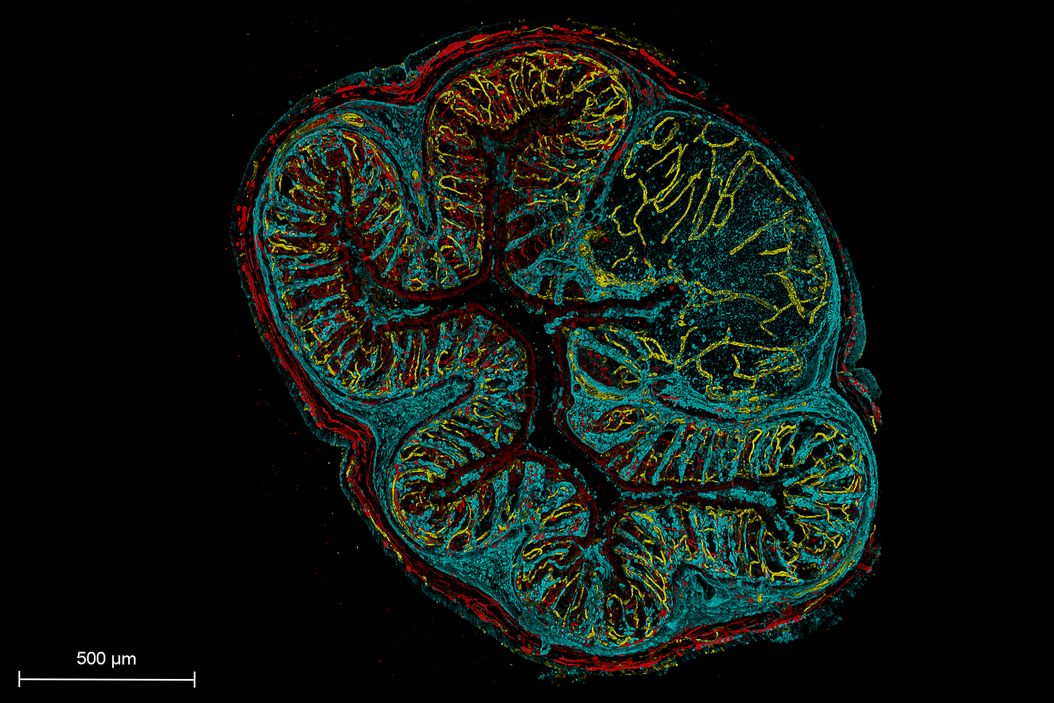 Light Sheet Webinar Teaser Image Colon-mouse-lightsheet-webinar-teaser.jpg