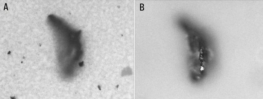 Particle imaged with optical microscopy where the images are focused on the A) filter surface (bottom of the particle) and B) top of the particle. The particle height can be measured in this way.