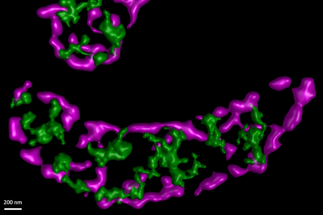  STED_sheds_insight_on_mitochondrial_protein_synthesis_teaser.jpg