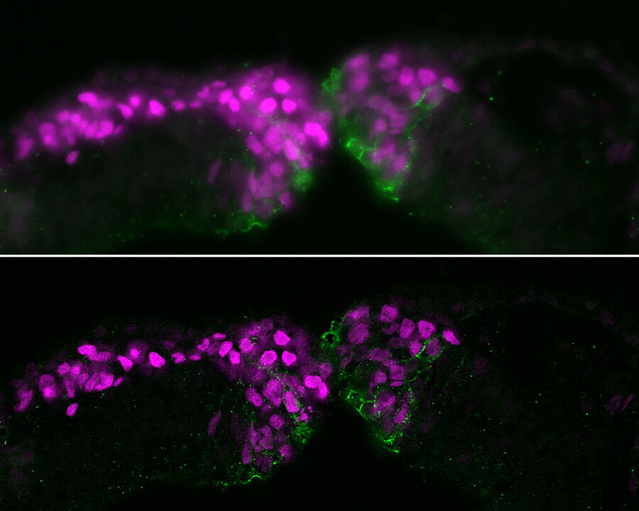 Raw widefield data (top) and THUNDER image (bottom) of a chicken-embryo cross section at the level of the midbrain showing neural crest cells and cadherin-6B molecules. 