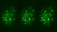 These images illustrate the need for multiple z-slices to capture all gH2Ax foci in a given cell and get an accurate count. 