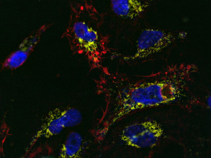 U2OS cells labelled with SiR Actin, TMRE, CellEvent™, and DAPI; 13-hour time-lapse imaging; apoptosis-inducer staurosporine