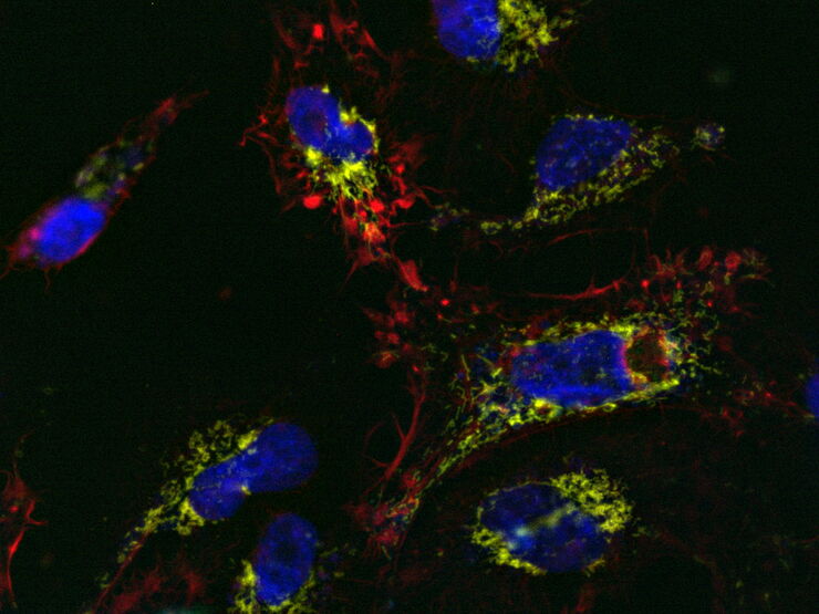 [Translate to chinese:] U2OS cells labelled with SiR Actin, TMRE, CellEvent™, and DAPI; 13-hour time-lapse imaging; apoptosis-inducer staurosporine