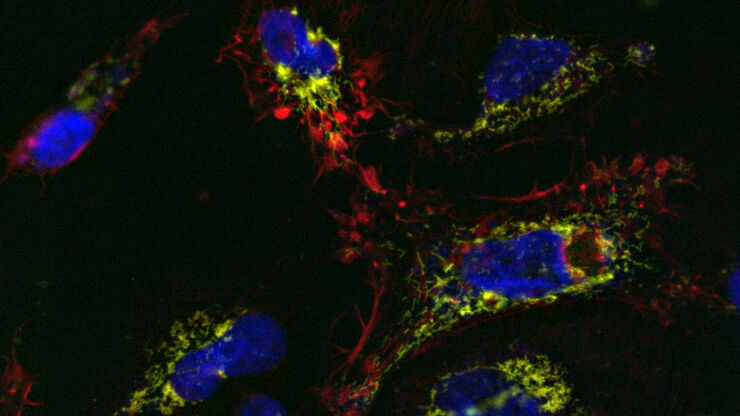 U2OS cells labelled with SiR Actin, TMRE, CellEvent™, and DAPI U2OS cells labelled with SiR Actin, TMRE, CellEvent™, and DAPI; 13-hour time-lapse imaging; apoptosis-inducer staurosporine