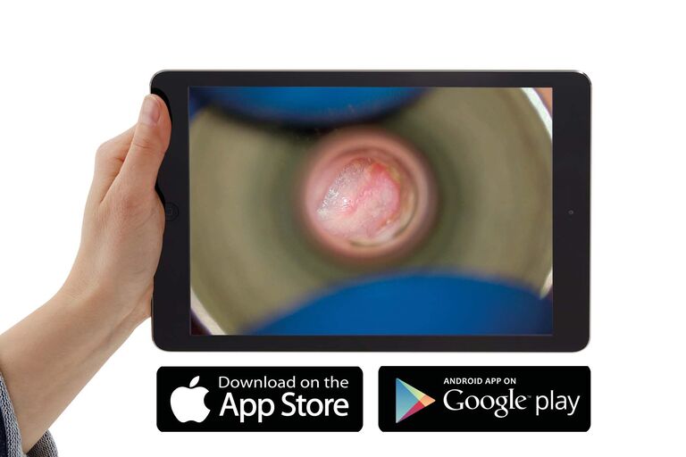 O tablet mostra uma imagem da aplicação diagnóstico em otorrinolaringologia, cortesia do Prof. Dr. Thomas Linder, Luzerner Kantonsspital, Lucerne, Suíça.
