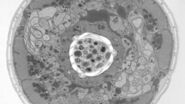 Structural details of the C. elegans, head in cross-section. Courtesy of Müller-Reichert T, MPI-CBG, Dresden, Germany, and McDonald K, University of California, Berkeley, USA.