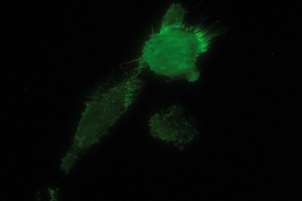TIRF image of brest carcinoma tumor cells expressing GFP tagged cell adhesion Molecule CD44 that is expressed on the cell membrane, imagined in TIRF. TIRF.jpg