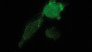 TIRF image of brest carcinoma tumor cells expressing GFP tagged cell adhesion Molecule CD44 that is expressed on the cell membrane, imagined in TIRF.