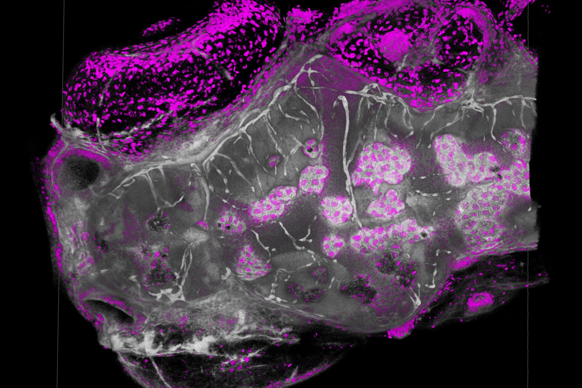 Traditional Confocal
