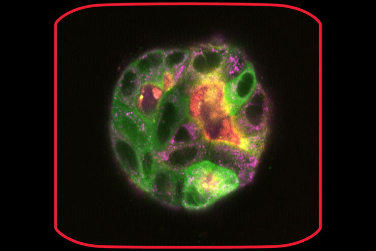 MDCK cysts on day 9 MDCK cysts on day 9