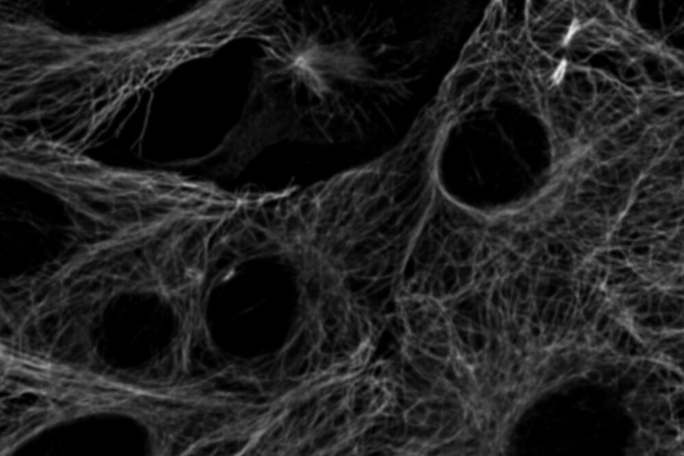 Cytoskeleton structures