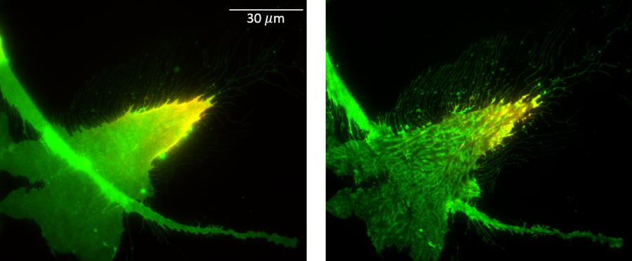 Randomly polarized RPE-1 (retinal pigmented epithelial) cell migrating on fibronectin.