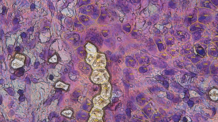 Single cells collected via laser microdissection as part of the Deep Visual Proteomics workflow.