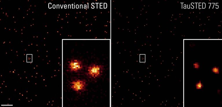 Imágenes STED y ADN origami: la línea TauSTED 775 proporciona resoluciones <30nm en GATTA-Bead R cuyo tamaño nominal es de 23nm. Barra de escala: 1 µm.