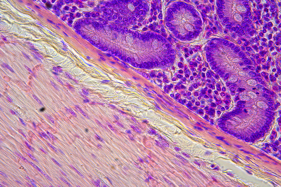 This overview image at 5x magnification shows three distinct layers of tissue in the duodenum