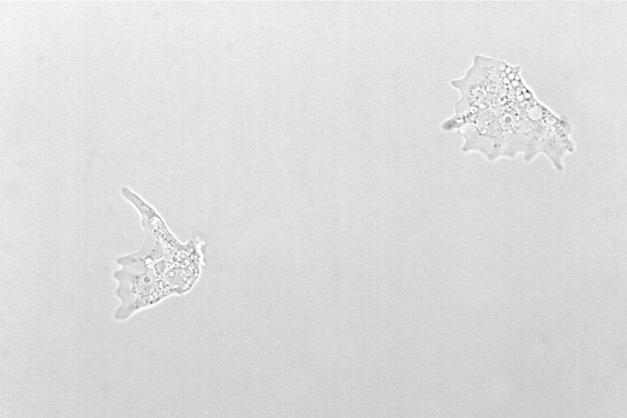 Bright Field Amoeba Proteus, bright field microscope