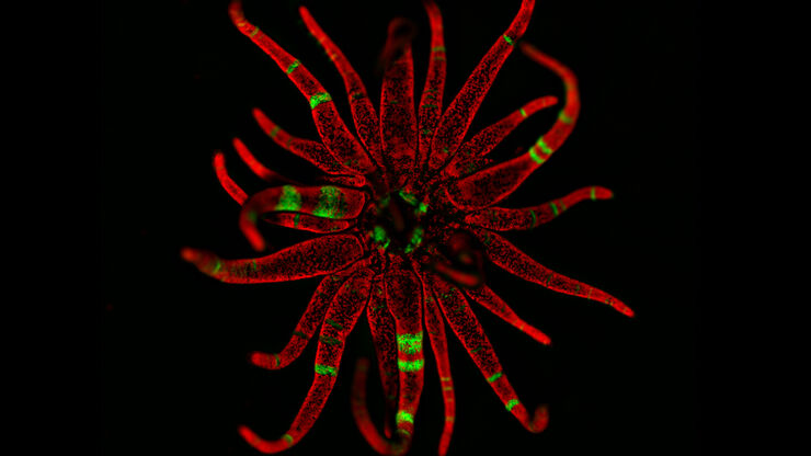 Sea anemone polyp (Exaiptasia pallida) - THUNDER Imager Model Organism