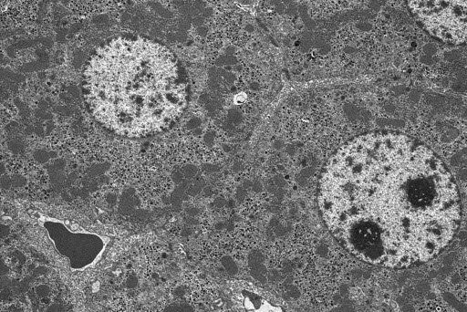 Mouse liver (immersion fixed). 