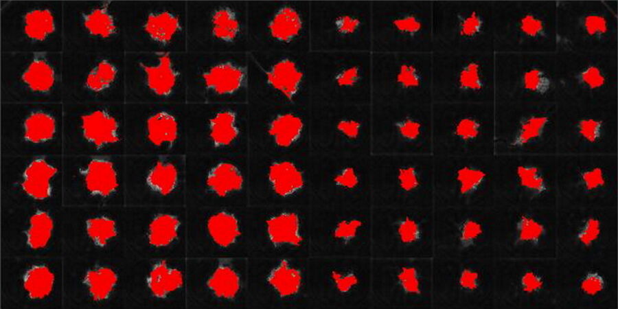 MDCK cells stably transfected with MX1-GFP with trained pixel classifier