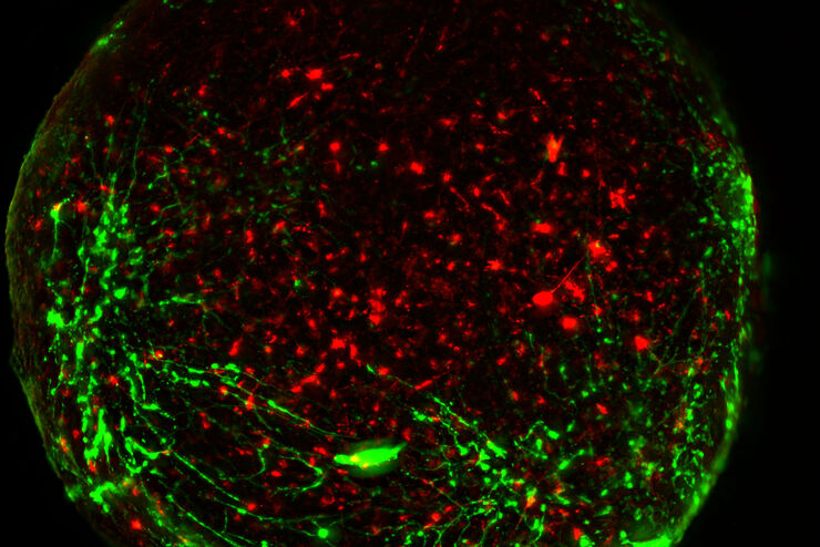 Virally labeled neurons (red) and astrocytes (green) in a cortical spheroid derived from human induced pluripotent stem cells. Virally labeled neurons (red) and astrocytes (green) in a cortical spheroid derived from human induced pluripotent stem cells. THUNDER Model Organism Imagerwith a 2x 0.15 NA objective at 3.4x zoomwas used to produce this 425 μm Z-stack (26 positions), which is presented here as an Extended Depth of Field(EDoF)projection.