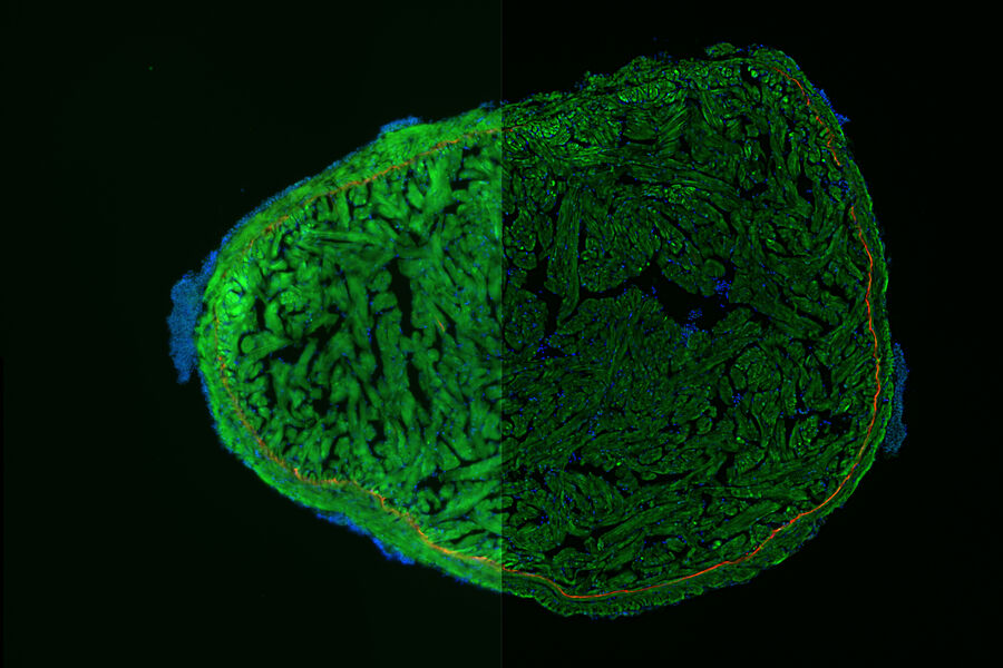 Zebrafish heart, DAPI (nuclei, blue), Tropomyosin (cardiomyocytes, red) and GFP (primordial cardiac layer, green). Courtesy of Anna Jazwinska, University of Fribourg, Switzerland.