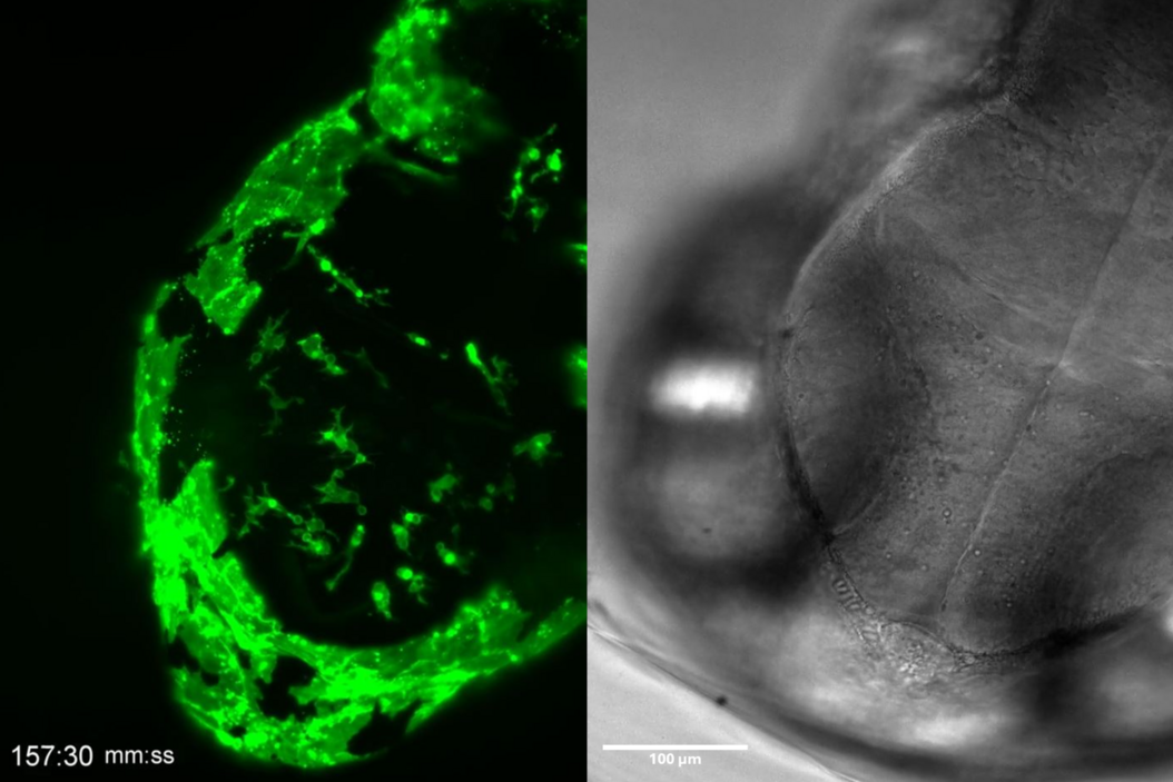 5 hour time-lapse maximum intensity projection of a zebrafish embryo along the z-axis at 3 days post fertilization. Left: microglia cells. Right: bright field channel. Courtesy of Prof. Francesca Peri, University of Zurich, Switzerland. 5 hour time-lapse maximum intensity projection of a zebrafish embryo along the z-axis at 3 days post fertilization. Left: microglia cells. Right: bright field channel. Courtesy of Prof. Francesca Peri, University of Zurich, Switzerland. Application_Note_Title_Image__1_.png