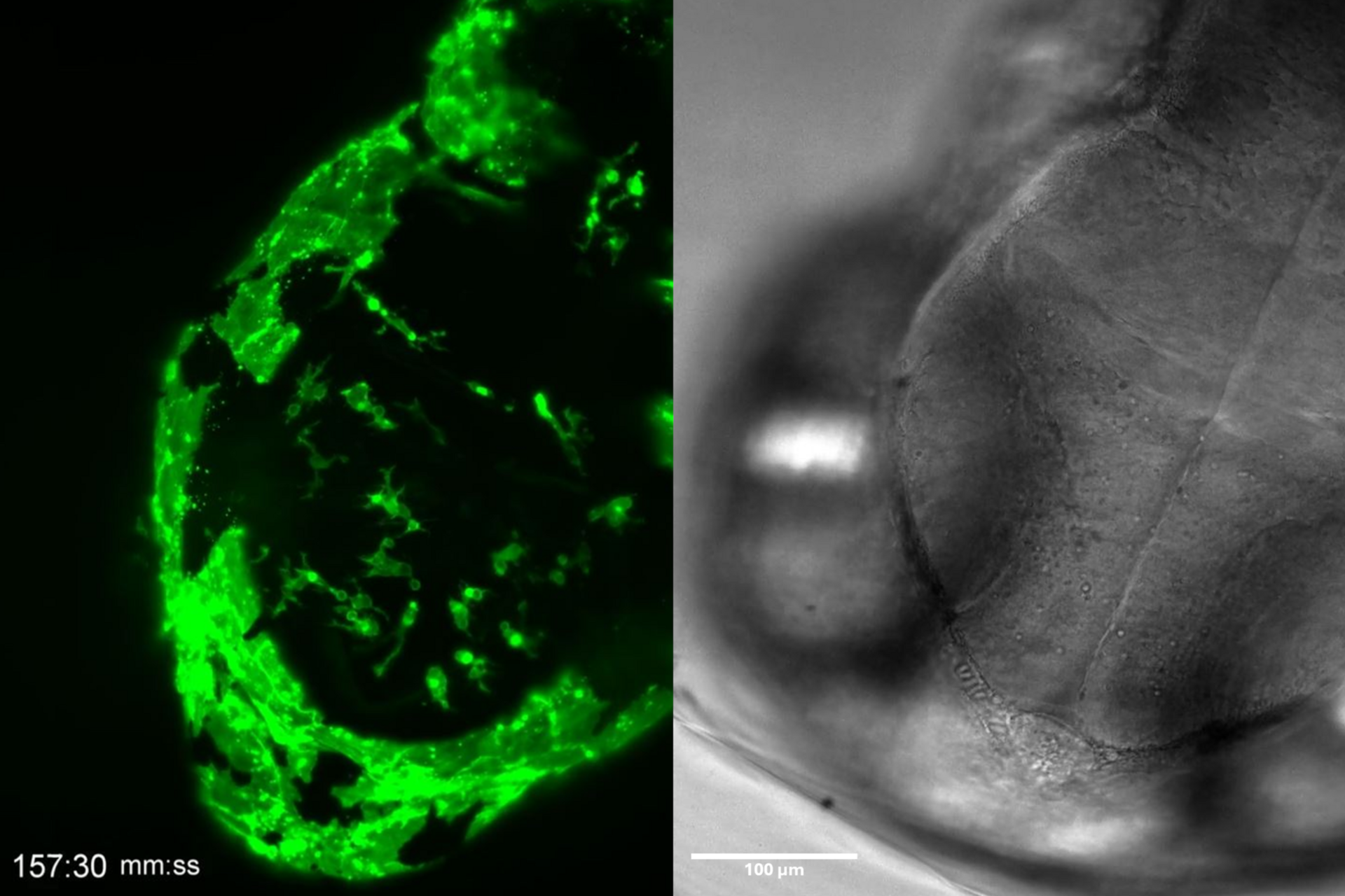 5 hour time-lapse maximum intensity projection of a zebrafish embryo along the z-axis at 3 days post fertilization. Left: microglia cells. Right: bright field channel. Courtesy of Prof. Francesca Peri, University of Zurich, Switzerland.