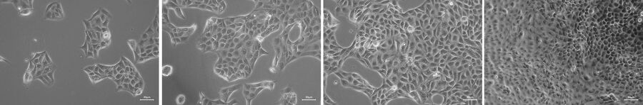 Example of a cell-growth quick check. MDCK cells with different confluency status. Cell culture images were acquired using Mateo TL in phase-contrast mode.