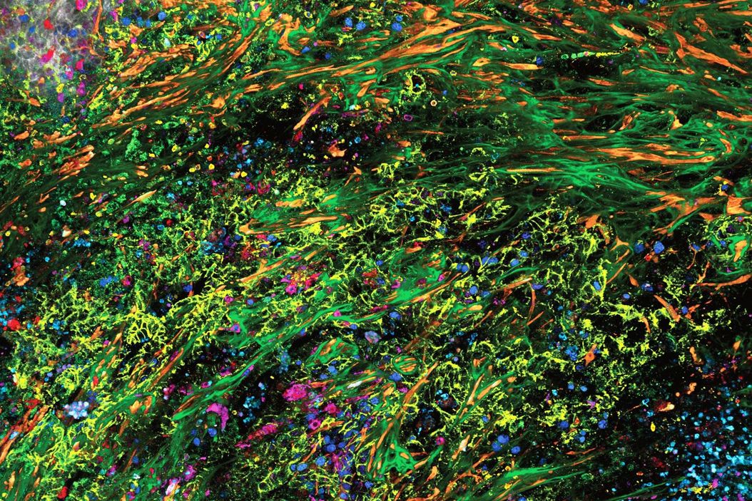 3D high-plex imaging in cancer immunology. Overview of a pancreatic tumor section in mouse model, labeled with 15 markers and imaged in one go using STELLARIS with SpectraPlex. (https://www.nature.com/articles/d42473-024-00260-7) Spectraplex-Stellaris-Header-V1.jpg