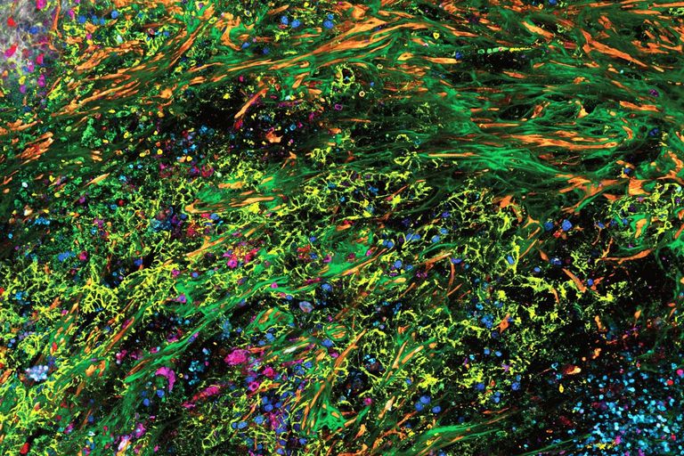 3D high-plex imaging in cancer immunology. Overview of a pancreatic tumor section (1.8 x 0.8 mm) in mouse model, labeled with 15 markers and imaged in one go using STELLARIS with SpectraPlex. 3D high-plex imaging in cancer immunology. Overview of a pancreatic tumor section (1.8 x 0.8 mm) in mouse model, labeled with 15 markers and imaged in one go using STELLARIS with SpectraPlex. Source: 3D high-multiplex imaging in cancer immunology. Kunz L., Speziale D., et al., Nat. Methods (2024).
https://www.nature.com/articles/d42473-024-00260-7