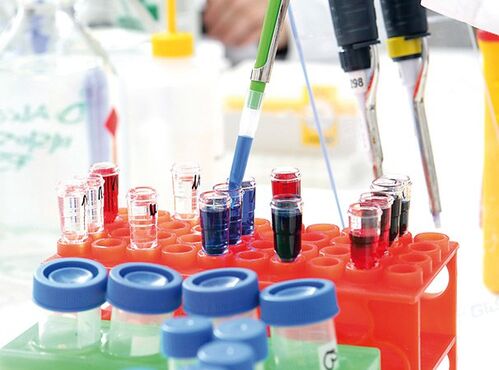 Labwork - extraction Labwork - extraction