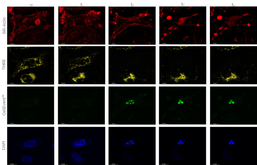 Four color caspase U2OS cells THUNDER
