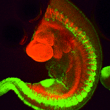 Mouse transgenic embryo, interlimb somites, Five interlimb somites of an E10.5 mouse transgenic embryo