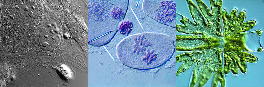 DIC images of mouse fibroplasts (connective tissue cells), Transdescantia (wildflower), and Micrasterias (green algae).