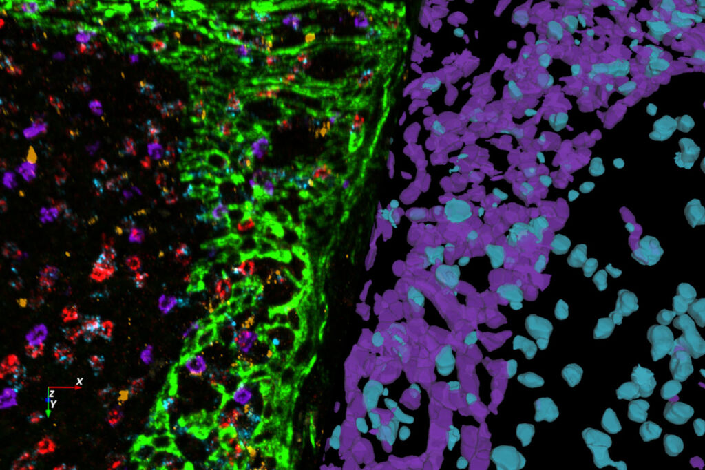 Csm Multiplexed Human Tonsil Tissue Labeled With A Panel Of 8 OPAL Dyes And DAPI 54b7f71d78