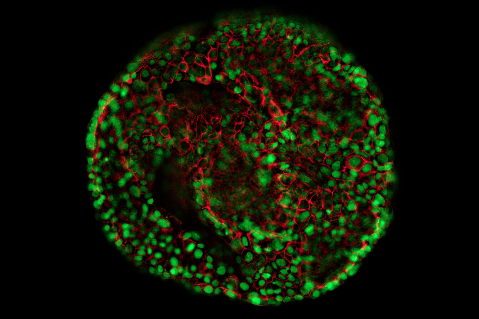 类器官和 3D 细胞培养显微镜解决方案