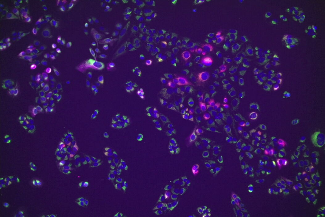 U2OS cells stained with Hoechst for nuclei (blue), MitoTracker green (Mitochondria structure, green) and TMRE (active mitochondria, magenta) and SiR for tubulin (red). Simultaneous acquisition of four channel large area overview using Spiral scan feature using the 10x/1.20 CS2 Water MotCORR objective. U2OS_cells_four_channel_Spiral_scan_Mica.jpg