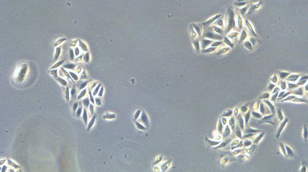 Microscope image of cultured cells at the bottom of a dish.