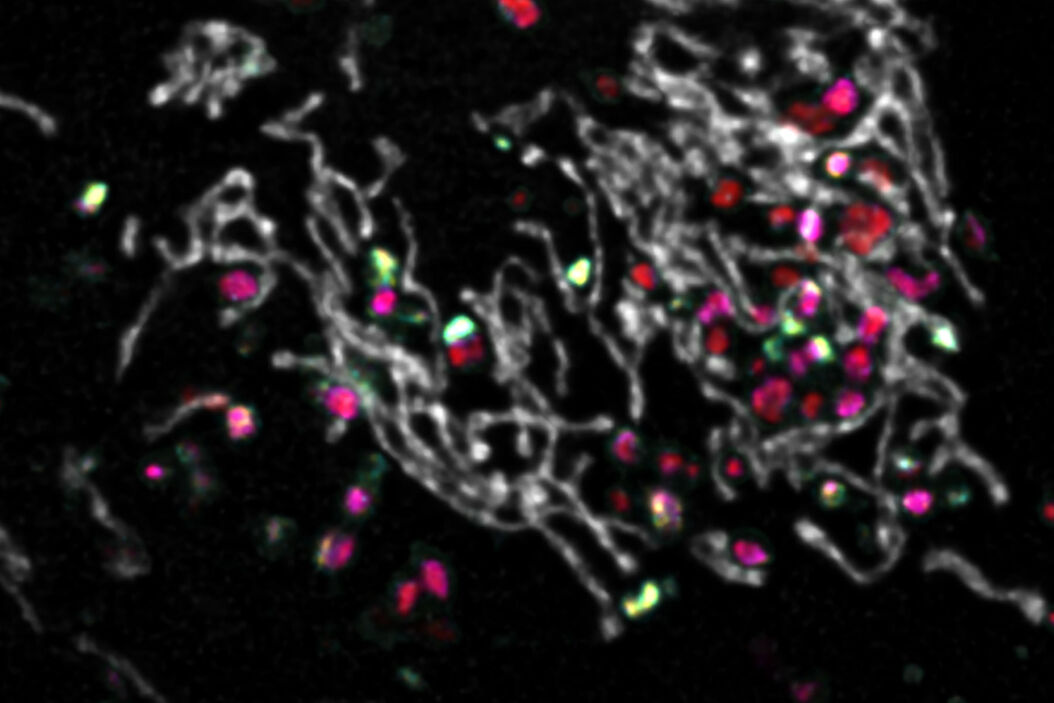  Endocytic-Vesicles-Webinar.jpg