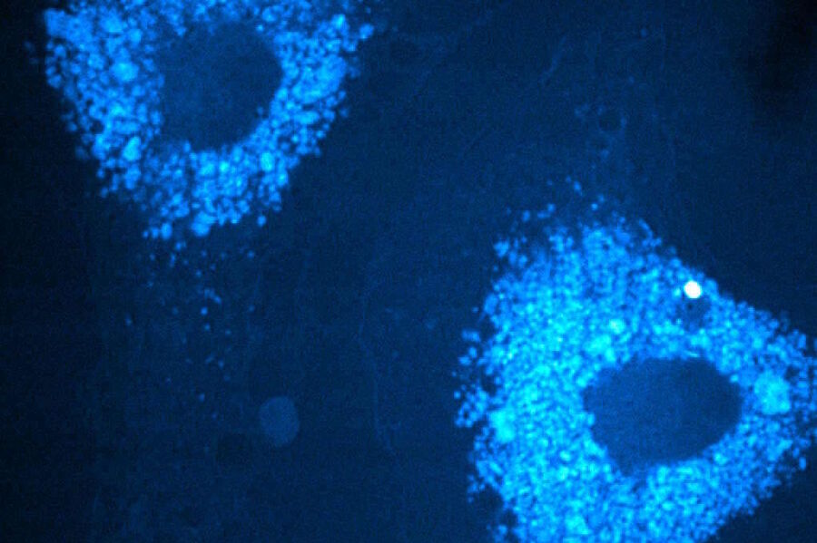 Lipid accumulation in M1 macrophages.