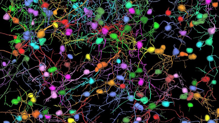 THY1-EGFP labeled neurons in mouse brain processed using the PEGASOS 2 tissue clearing method. Neurons were traced using Aivia’s 3D Neuron Analysis – FL recipe. Image credit: Hu Zhao, Chinese Institute for Brain Research. THY1-EGFP labeled neurons in mouse brain processed using the PEGASOS 2 tissue clearing method, imaged on a Leica confocal microscope. Neurons were traced using Aivia’s 3D Neuron Analysis – FL recipe. Image credit: Hu Zhao, Chinese Institute for Brain Research.