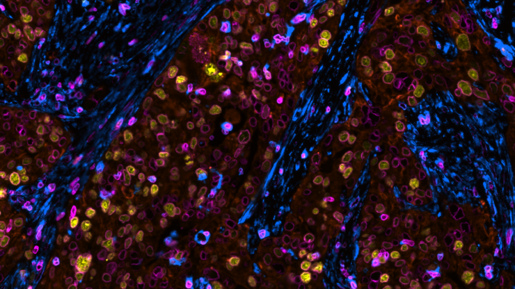 Reveal Spatial Biology with Clarity