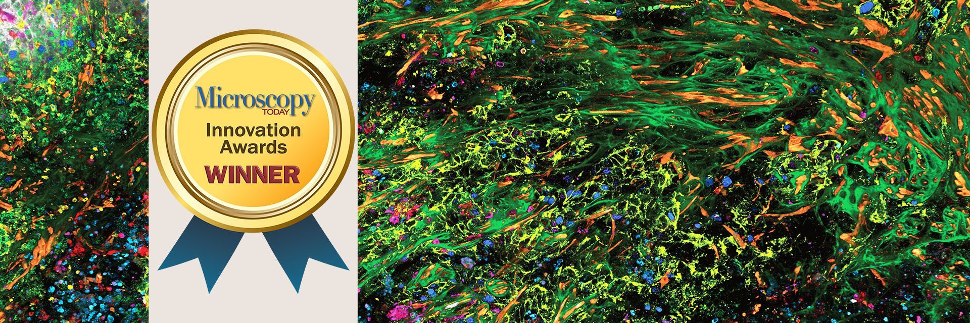 3D high-multiplex imaging in cancer immunology. Kunz L., Speziale D., et al., Nat. Methods (2024)