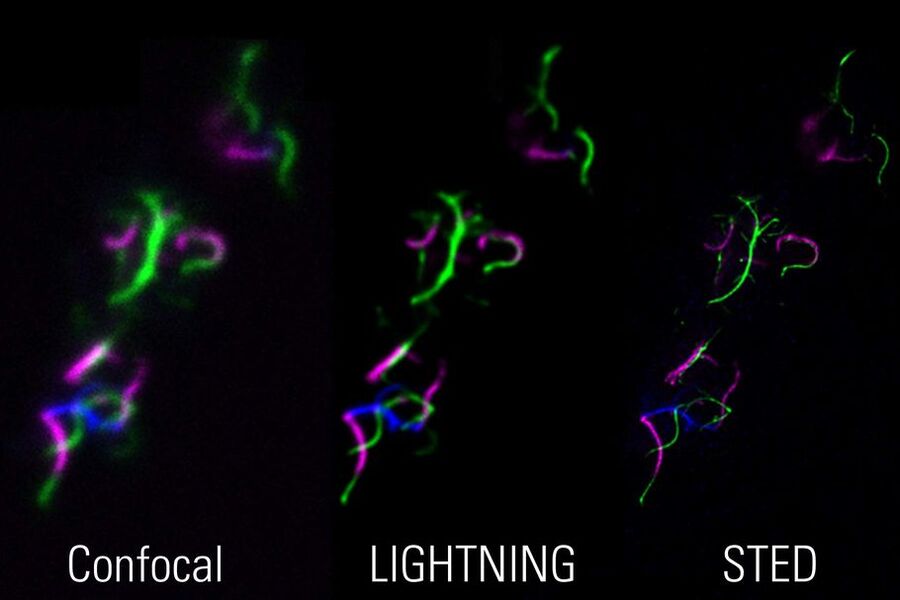 Images of bacterial flagella: Correlative 3-color confocal-LIGHTNING-STED imaging allows the simultaneous use of the complementary approaches for the investigation and validation of samples. Sample courtesy of Marc Erhardt, Humboldt-Universität, Berlin, Germany.