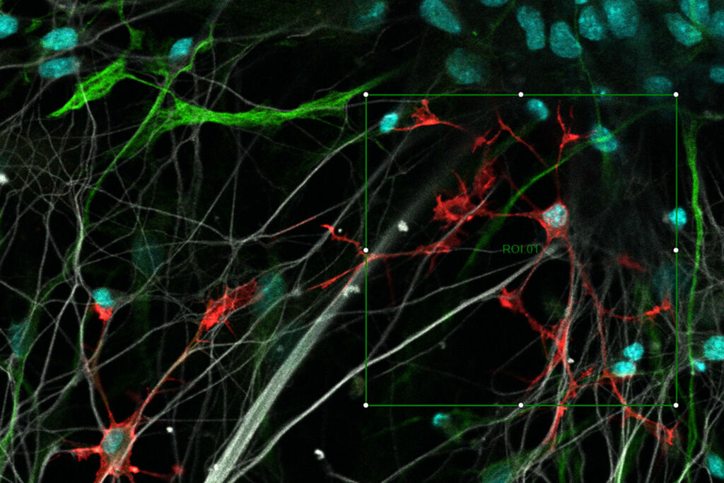 Resolved Field Number (RFN) | Learn & Share | Leica Microsystems