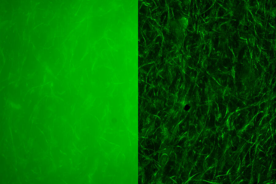 Fiber - THUNDER Imager 3D Cell Culture