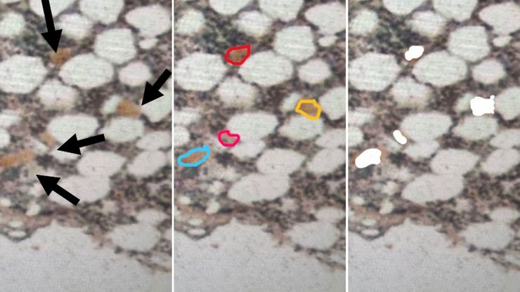 Low-input spatial proteomics workflow for megakaryocyte isolation from bone marrow.