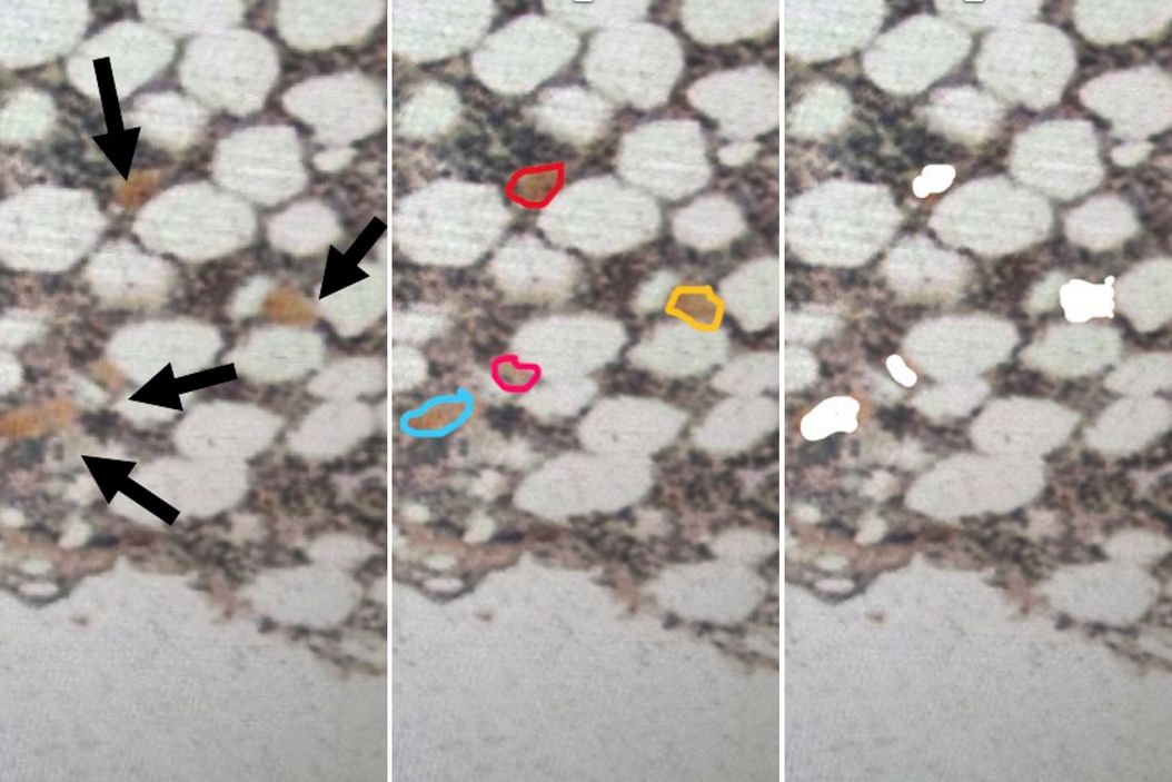 Low-input spatial proteomics workflow for megakaryocyte isolation from bone marrow. Low-input_spatial_proteomics_workflow_for_megakaryocyte_isolation_from_bone_marrow.jpg