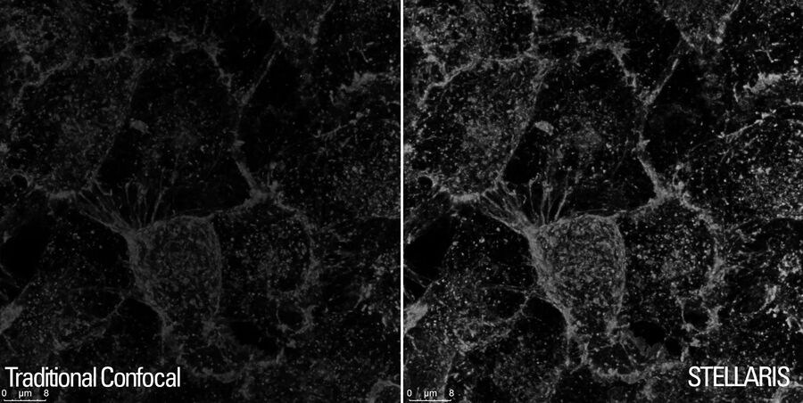 HeLa cells labeled with WGA-CF488 dye.