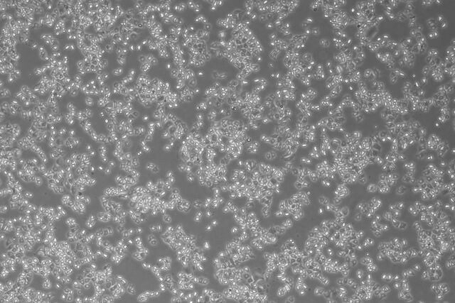 Hela Cells. Hela Cells.